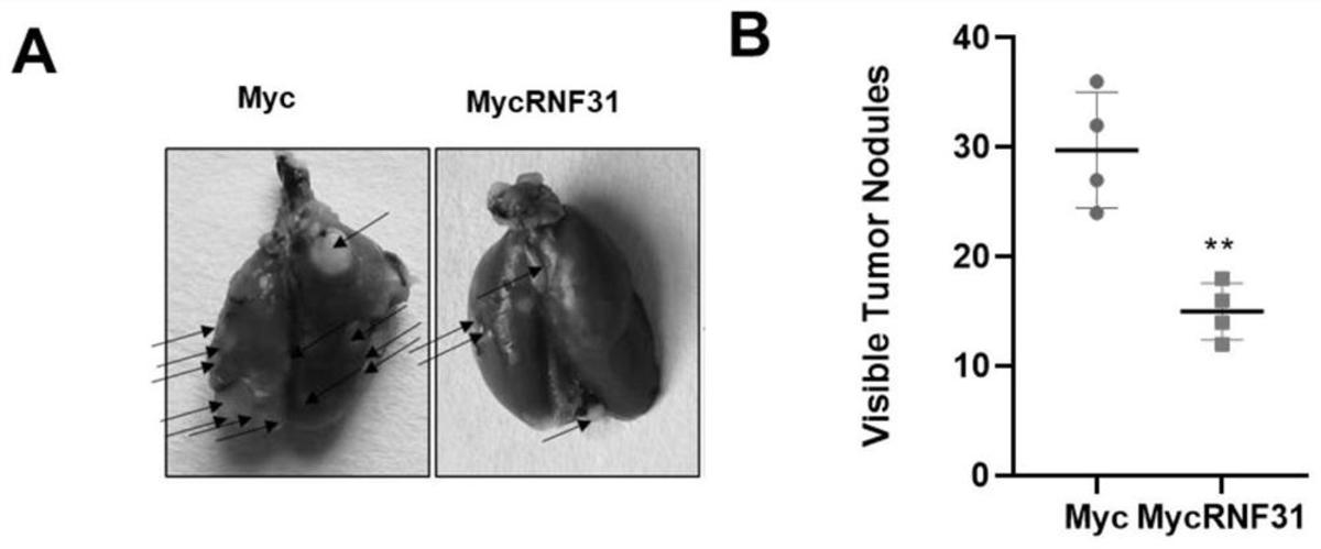 RNF31基因表達(dá)促進劑在制備治療TNBC的藥物中的應(yīng)用