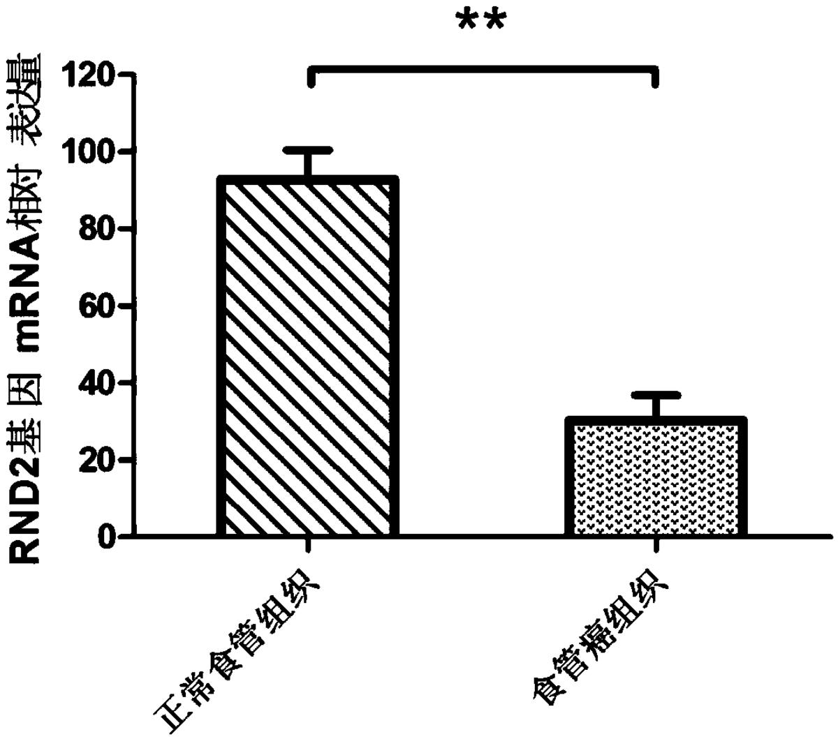 一種食管癌檢測、診斷或者預(yù)后評價制劑，治療食管癌的藥物及RND2基因的應(yīng)用